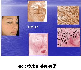 VISIA沿DxaƷB